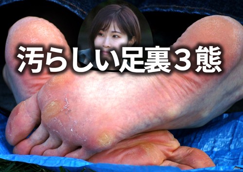 汚らしい足裏３態